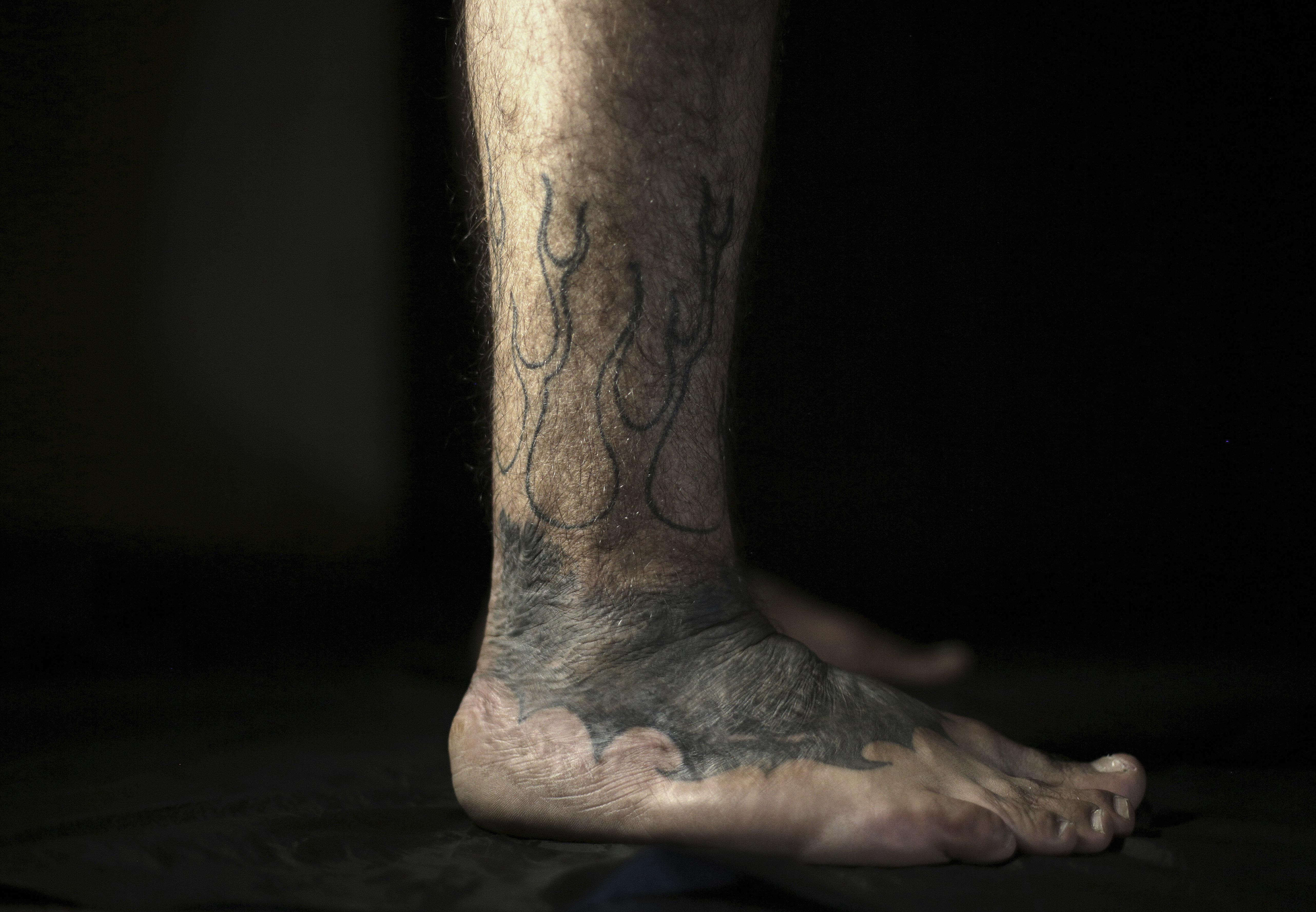 20 Tattoos Turning Scars and Birthmarks into works of art