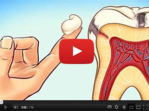 Teeth reconstruction video