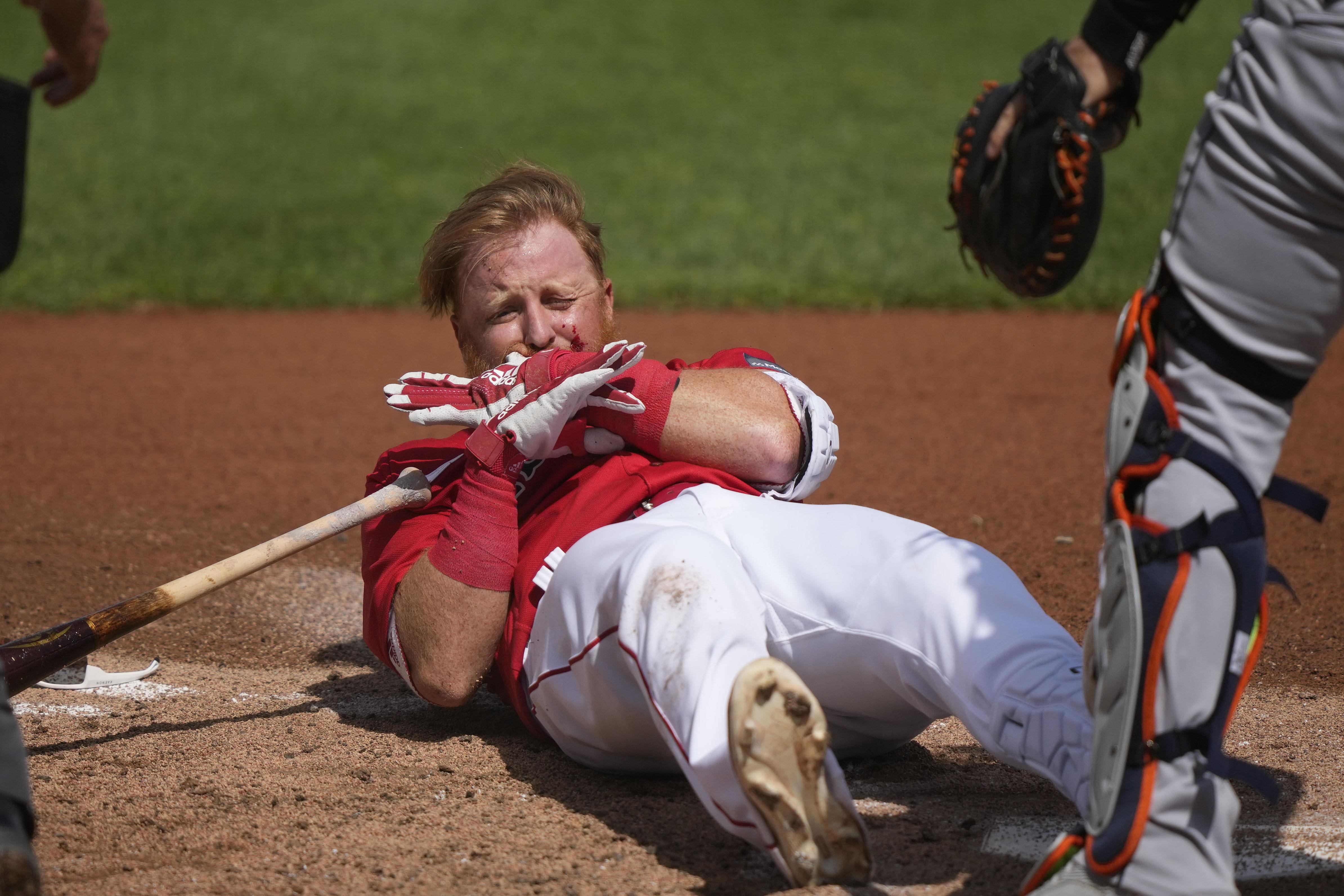 Red Sox's Justin Turner on playing some first base: 'I feel I'm a baseball  player' 