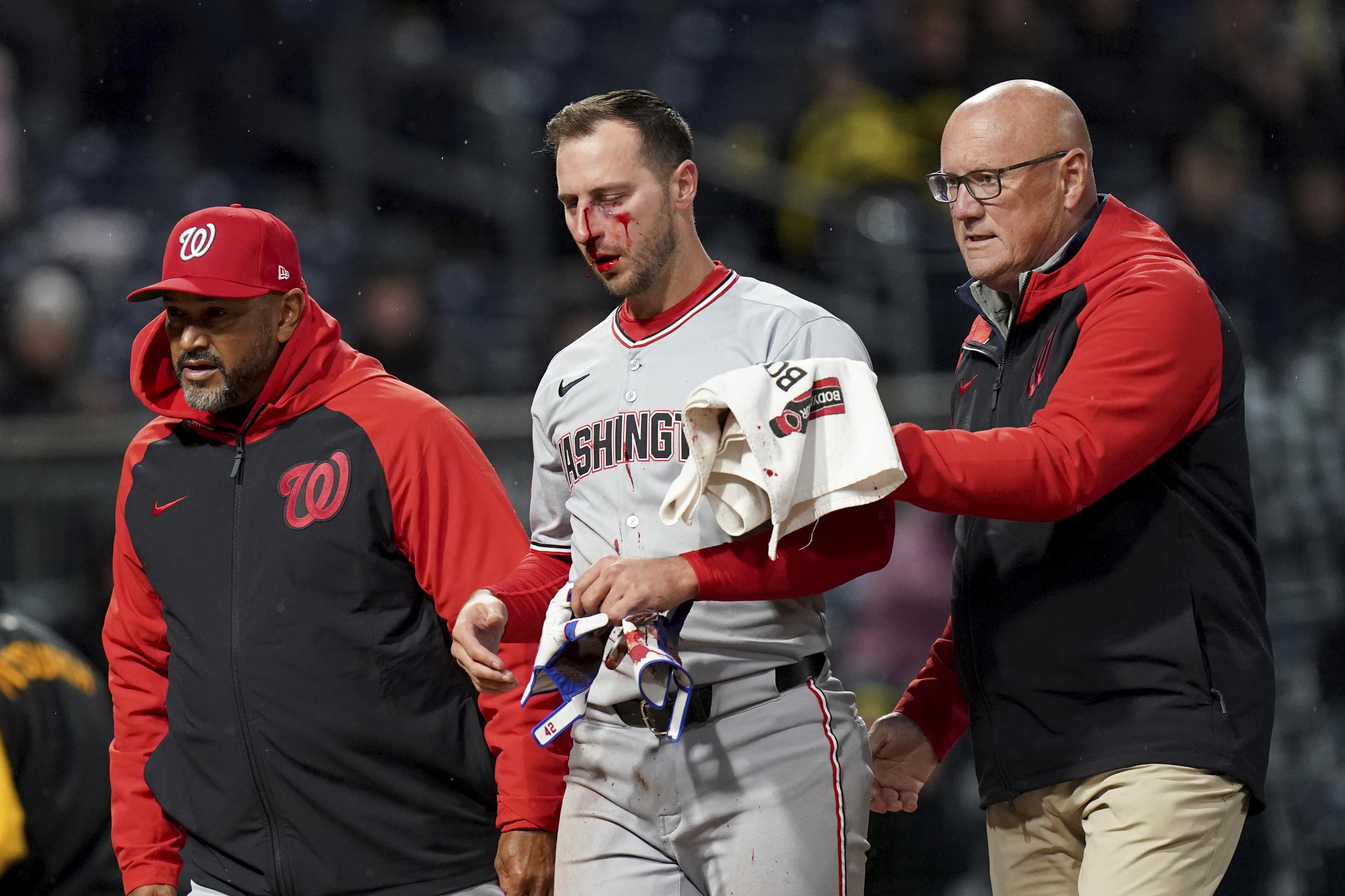 Nationals third baseman Paul DeJong placed on IL with fractured nose after being hit by pitch - Washington Times